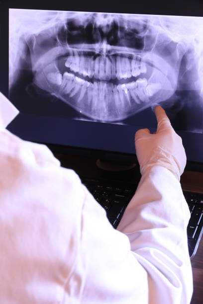 Best Emergency Dental Care for Abscessed Tooth in Huntington Beach, CA